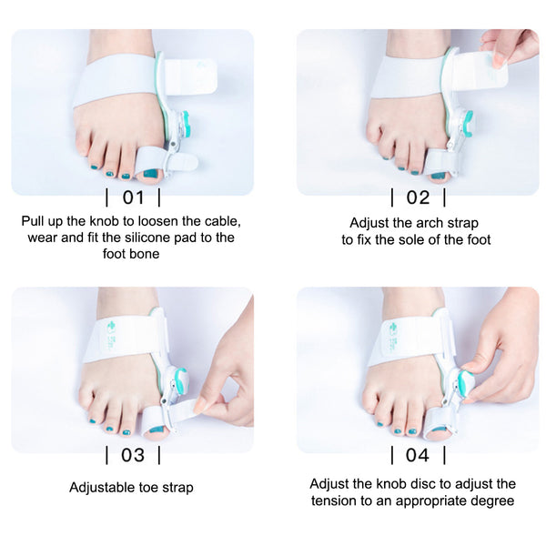 Upgraded Toe Bunion Corrector – Adjustable Orthopedic Splint for Pain Relief & Alignment