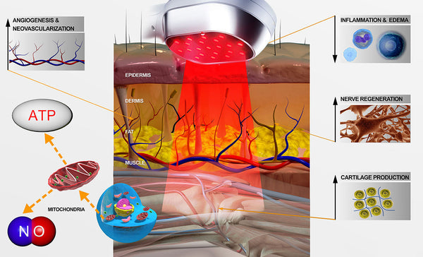 Upgraded Cold Laser Red Light Therapy Device