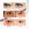 Eye Red Light Therapy - Reduce Fine Lines and Wrinkles