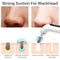 Blackhead Remover Pore Vacuum